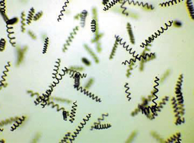 spiruline au microscope